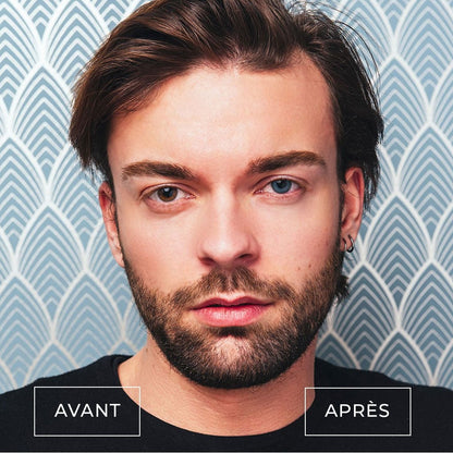 Lentilles de couleur Bleu vif avec correction - 3 mois